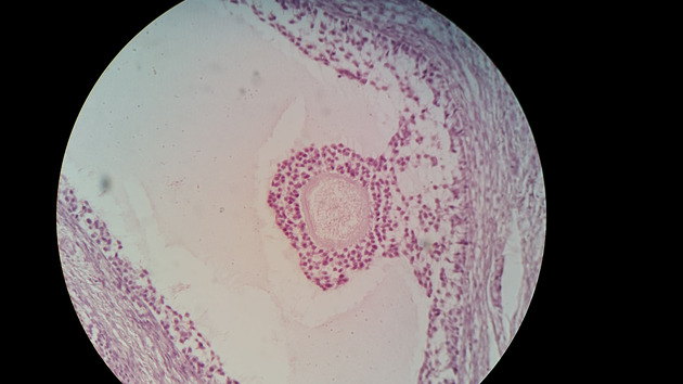 Ovary Graafian Follicle Slides - Ovary Graafian Follicle 013 400X